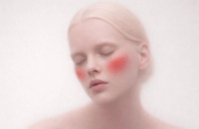 10 вопросов косметологу о розацеа: что важно знать каждому пациенту